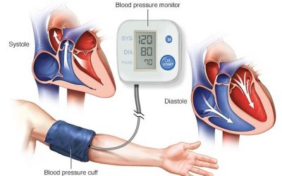 HYPERTENSION CHECKUP