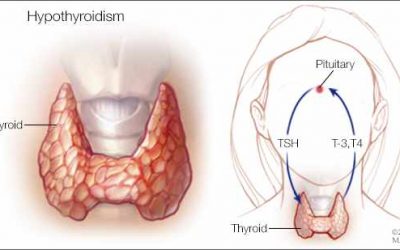 হাইপোথাইরয়েডিজম রোগীদের জন্য সেরা ডায়েট